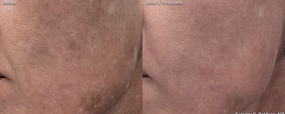 Before and After Image: Solaria - left-front-oblique