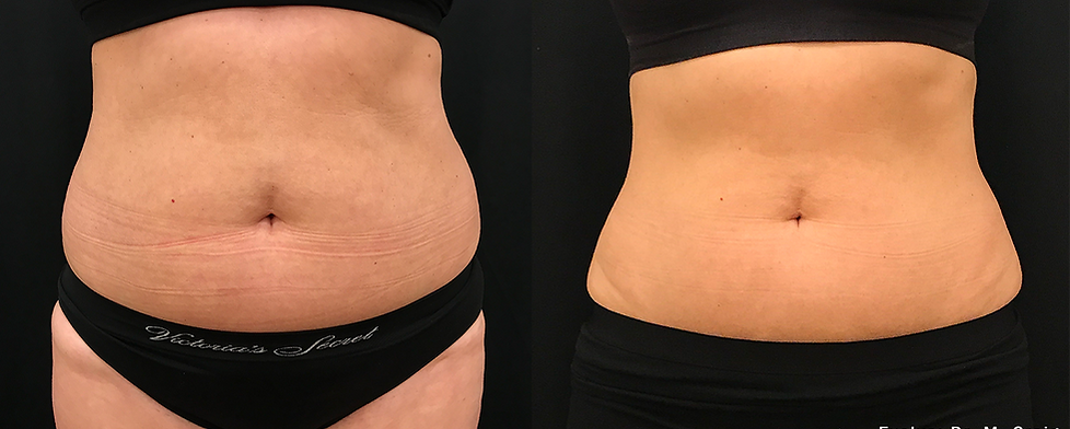 Before and After Image: Evolve - front
