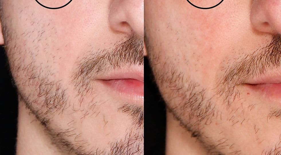 Before and After Image: Lumecca - front