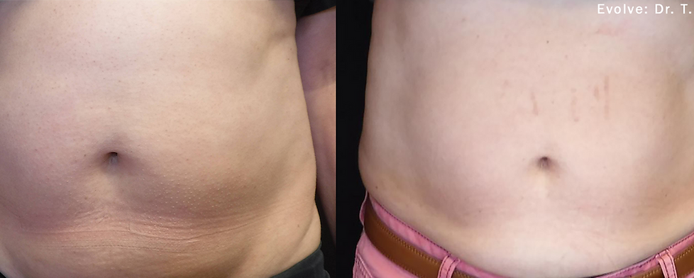 Before and After Image: Evolve - front