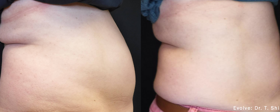 Before and After Image: Evolve - right-side